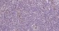LAMP1 Mouse mAb